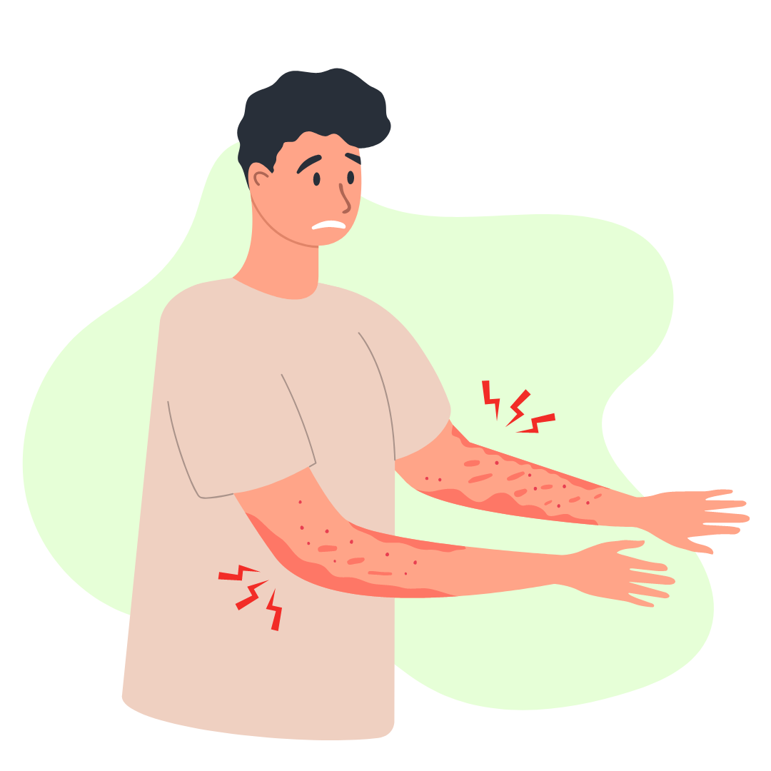 Man expressing frustration at eczema on his arms